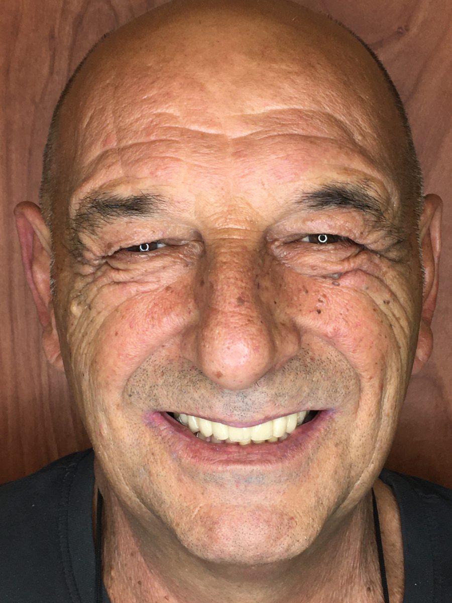 2-dopo